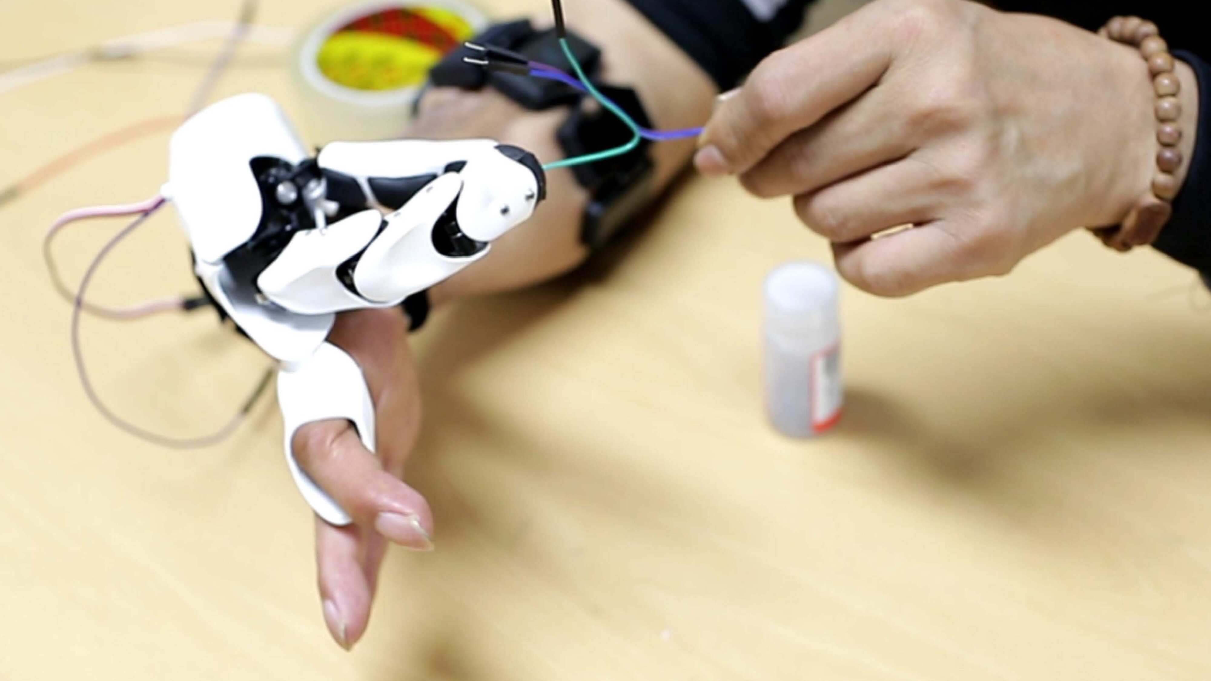 Prosthetic Finger Teaser